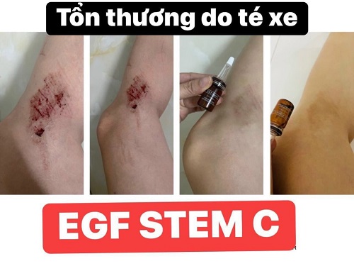 te bao goc